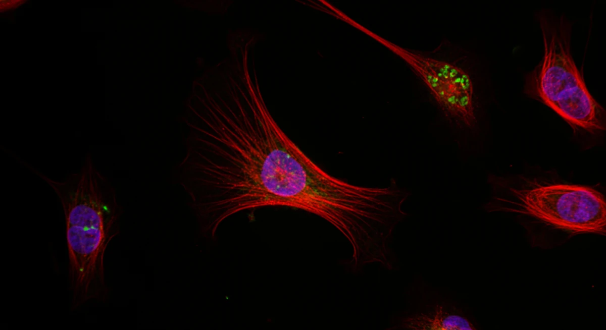 Mikroskopbilde av celler med fluorescent telomer-farging